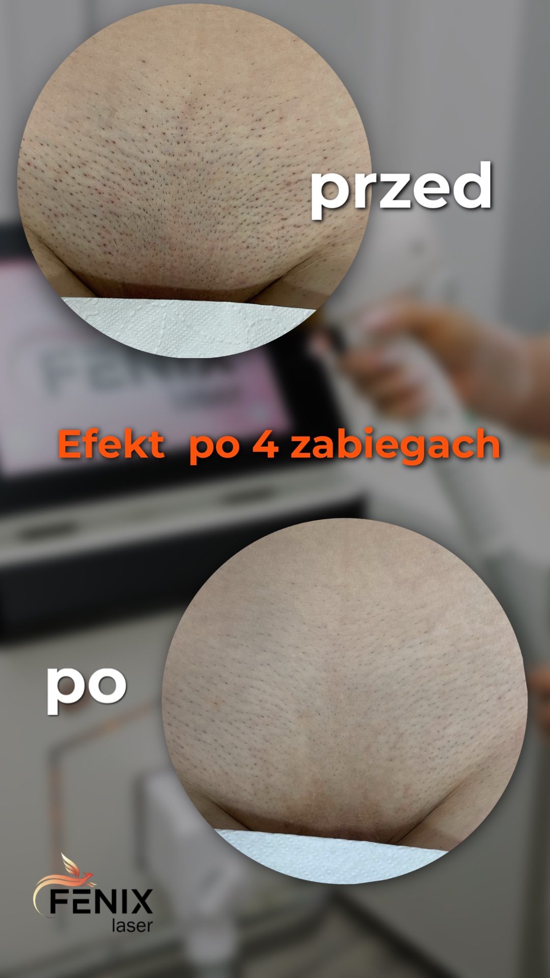 efekty4